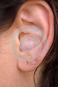 Entire ear