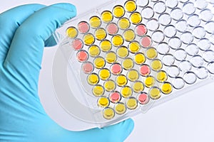 Enzyme-linked immunosorbent assay or ELISA plate photo