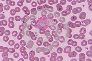 Eosinophil