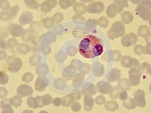 Eosinophil cell