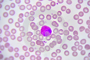 Eosinophil cell