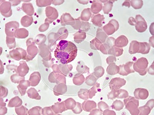 Eosinophil cell