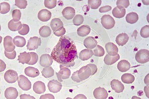 Eosinophil cell photo