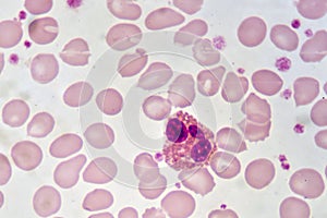 Eosinophil cell