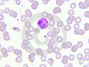 Eosinophil cell photo