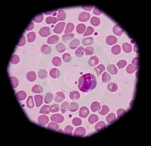 Eosinophil granulocytes