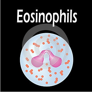 Eosinophil structure. Eosinophil blood cells. White blood cells. leukocytes. Infographics. Vector illustration on