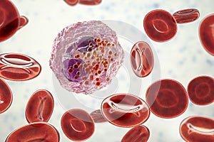 Eosinophil, a white blood cell