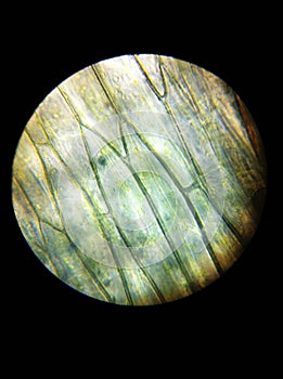 The epidermal cells of Cabbage photo