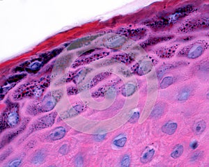Epidermis. Granular and cornified layers