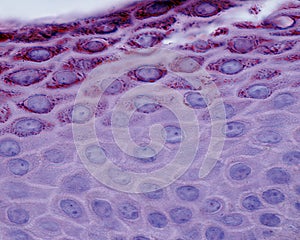 Epidermis photo