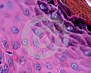 Epidermis. Spinous and granular layers photo