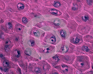 Epidermis. Stratum spinosum. Desmosomes