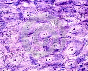 Epidermis. Stratum spinosum. Desmosomes