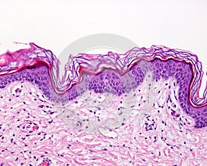 Thin skin. Hematoxylin-eosin photo