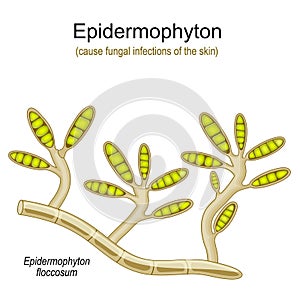 Epidermophyton floccosum. fungal infections