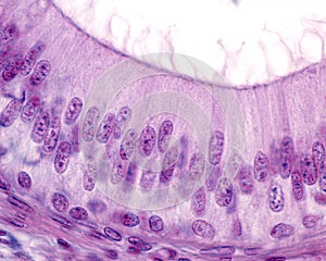 Epididymis. Pseudostratified columnar epithelium photo