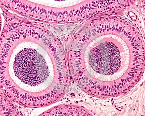 Epididymis. Pseudostratified epithelium photo