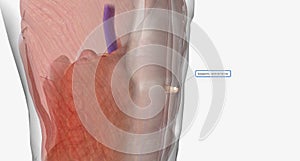 An epigastric ventral hernia is the most common type of ventral hernia