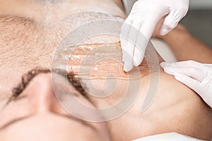 Epilation chest of young male