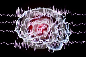 Epilepsy awareness concept photo