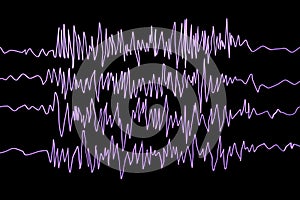 Epilepsy awareness. Electroencephalography in epilepsy patient during seizure attack