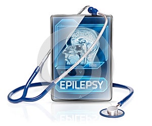 Epilepsy