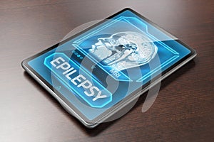 Epilepsy