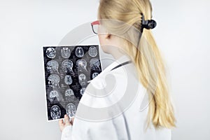 Epileptologist examines patient MRI and electroencephalogram. Concept treating epilepsy and helping people who suffer from this di