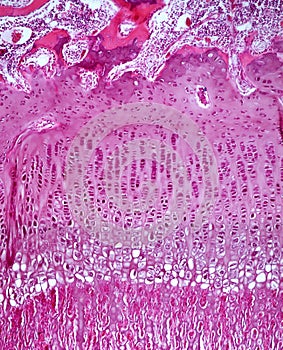 Epiphyseal plate