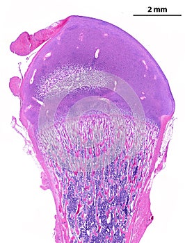 Epiphysis. Secondary ossification centre