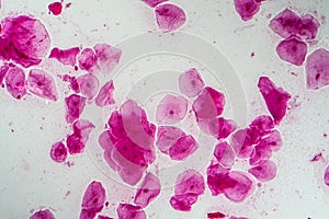 Epithelial cells with bacteria