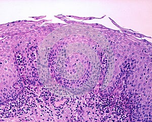 Epithelium of esophagus