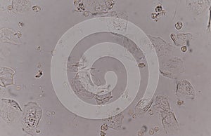 Epithelial tissue with bacteria cells yeast cells