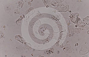 Epithelial tissue with bacteria cells yeast cells