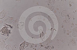 Epithelial tissue with bacteria cells yeast cells