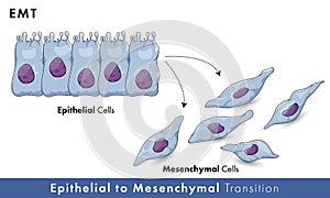 Epithelial to mesenchymal transition