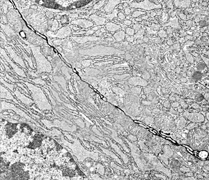 Epithelium. Intercellular space