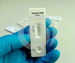 Epstein-Barr virus (EBV) rapid screening test photo