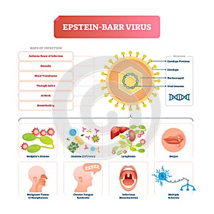 Epstein barr virus vector illustration. Labeled herpes disease explanation.