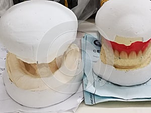 Equipment and tentative impressions in the dental clinic of a dental technician