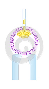 ESC isolation