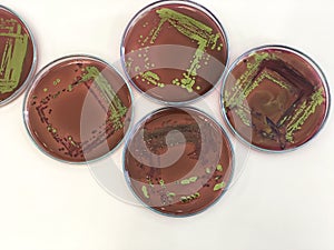 Escherichia coli E.coli cultured with Eosin Methylene Blue EMB Agar in Petri dish show the metallic green sheen colonies using photo