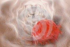 Esophageal cancer, illustration photo