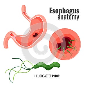 Esophagus anatomy and helicobacter pylori medical promo poster photo