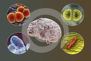 Etiology of bacterial meningitis