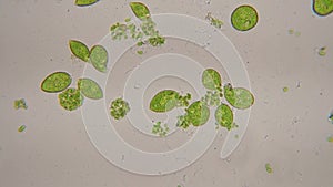 Euglena is a genus of protazoa