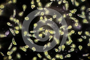 Euglena is a genus of single-celled flagellate Eukaryotes under microscopic. photo