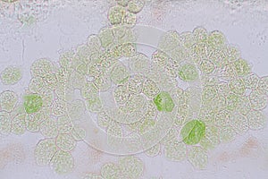 Euglena is a genus of single-celled flagellate Eukaryotes under microscopic. photo