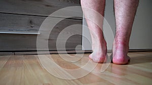 European man after achilles tendon rupture operation trains his healing achilles tendon with painful exercise to regain strength